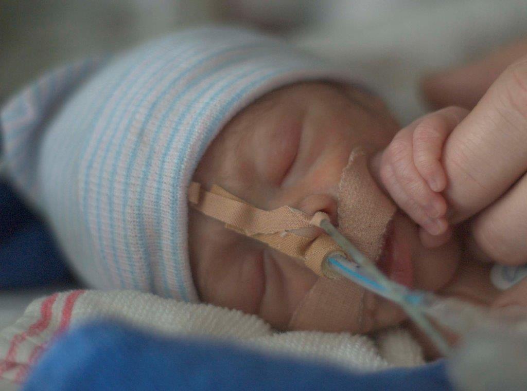 Pasgeborene op de neonatologie intensive care